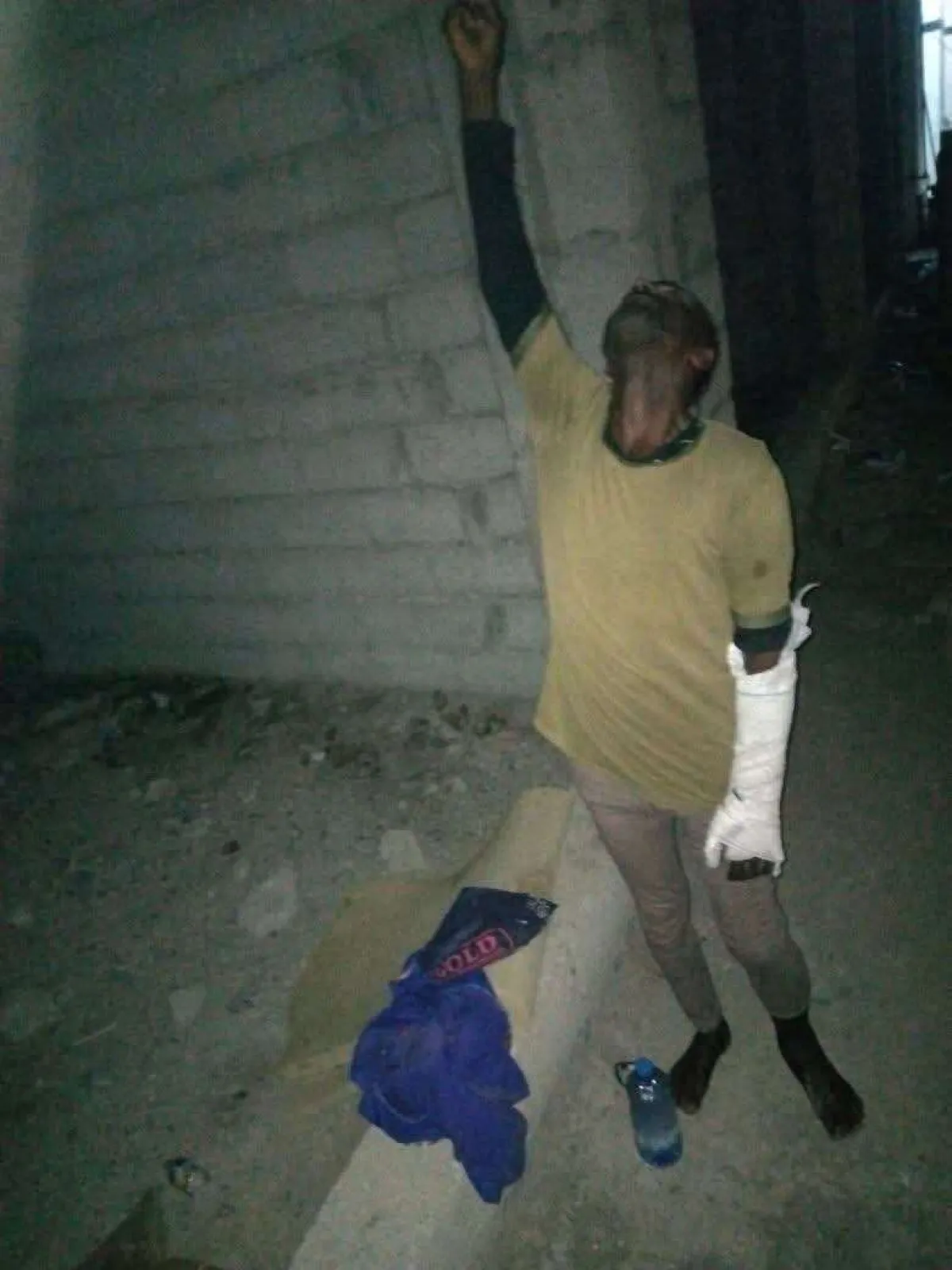 إصابة مهاجر إثيوبي بكسور خطيرة إثر حادث سير في لحج