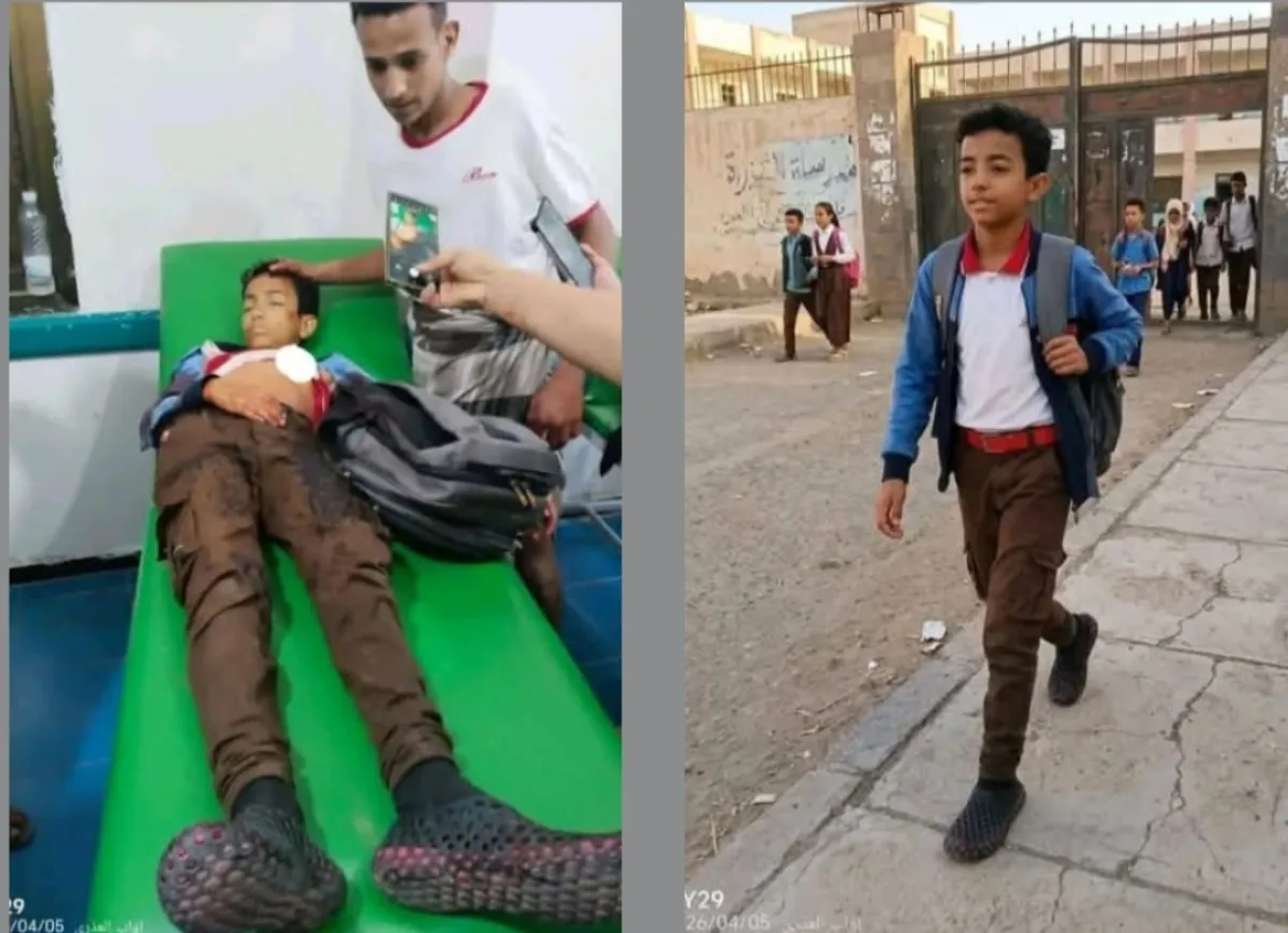 استشهاد طفل برصاص قناص حوثي في حي الروضة بمدينة تعز